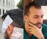 باقي الخير في أبناء المغرب.. الدكتور "الربون" يعيد الابتسامة لمشجع تطواني تعرض لتشوه على مستوى الوجه إثر "صراع الفصائل"